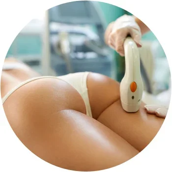 Full Legs Laser Hair Removal Special at Bonita Laser in Mississauga using Soprano ICE Platinum Technology